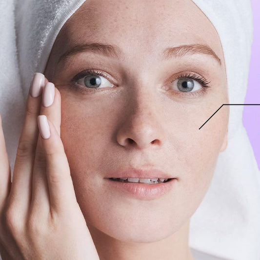 Giải pháp nào cho Nám và Tàn nhang lâu năm, khó chữa?